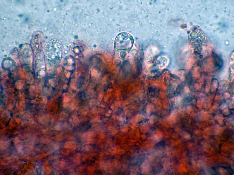 Amanita citrina 10 - Basidios cara-001